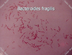 Bacteriodes fragilis group