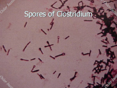 Clostridium continued...