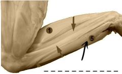 A narrow muscle lying at the most anterior side of the tibio-fibula and divided distally into two parts.