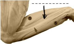 A long narrow muscle adhering closely behind the tibio-fibula.