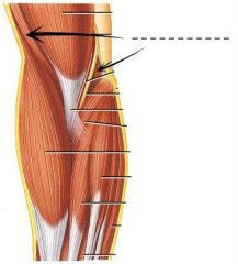 The next muscle anterior to the lateral head of the triceps brachii.