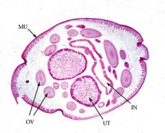 Ascaris lumbricoides (female adult)


 


-Causes Ascaris pneumonitis (a.k.a. Loeffler's syndrome)


-Note uterus (UT), ovaries (OV), intestine (IN), longitudinal muscle (MU), and cuticle (outer membrane)