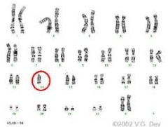 The condition in which there is a single chromosome in place of a homologous pair.