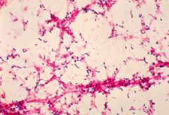 - the value of gram stain and culture is controversial. It should probably be performed in ALL patients HOSPITALIZED for CAP
- a good sputum specimen has > 25 PMNS and <10 epithelial cells per low power field
- commonly contaminated with oral se...