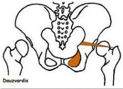 where do tendons of obturator internus insert ?

WHATS ITS ACTION ?