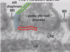 Slit diaphragm between podocyte foot processes
Mutations in slit diaphragm proteins (i.e. mice KO, human disease) results in nephrotic mice or familial nephrotic syndrome.