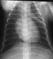Normal Mediastinum 

Structures that are normally seen
- Trachea
- Heart
- Aorta
- Caudal vena cava
- Fat

Structures occasionally seen
- Gas in the esophageal lumen
- Thymus (Dogs < 1 yr)

Structures NOT normally seen
Won’t see an outline o