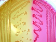 What is the significance of the colour changes on this MacConkey bile lactose agar plate?