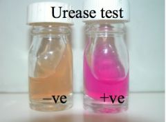The urease, H2S & lysine decarboxylase tests  can be used to distinguish both -------- & --- -------- genus of enteric bacteria.