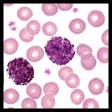 -hypersensitivity, release Histamine (mast cells in tissue)
-large dark blue/purple granules in cytoplasm
- 0-1.6%