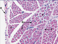 Histology of adult skeletal muscle (transverse section)