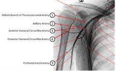 The artery labeled 4 on the arteriogram is the posterior humeral circumflex artery, which is the primary blood supply to the humeral head, and most likely to lead to AVN when injured. 


deltoid branch of the thoracoacromial artery
Axillary art...