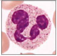 What type of white blood cell is this, is it granulocyte or a agranulocyte? 