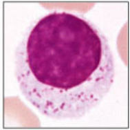 What type of white blood cell is this, is it granulocyte or a agranulocyte?    