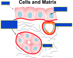 Label:


 


Cells


Nucleus


Basement Membrane


Blood Vessel


Matrix