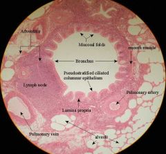 Pseudostratified columnar w/ cilia


 


Simple columnar w/cilia