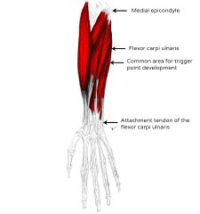 o:medial epicondyle of humerous and olecranon process of ulna
i:base of fifth metacarpel
a:flexes wrist, works with extensor carpi ulnuras to adduct wrist
