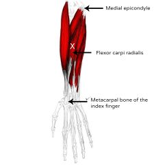 o:medial epicondyle of humerus
i:base of 2nd and 3rd metacarpels
a:flexes and abducts wrist