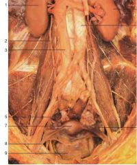 female retroperitooneal organs 