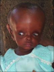 The size and contour including deformities, depressions, lumps, or tenderness. 
Examples: hydrocephalus (picture) & plagocephaly