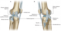 Tibial collateral ligament
Broad, flat, limits extension and abduction of the leg
Attached to the medial meniscus and blends with joint capsule
More commonly damaged
Fibular collateral ligament
Round, cord-like, limits adduction
Separate from join...