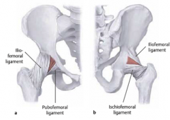 Iliofemoral (inverted Y-shape, thickest)
Pubofemoral
Ischiofemoral
Thickenings of the capsule
Taut on extension - most stable position