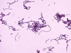 Streptococcus pyogenes
(Group A)