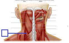 Proximal: spinous processes of T3-T6
Distal: transverse processes of cervical vertebrae
Action: one side: turns head to same sideBoth sides: extends head & neck