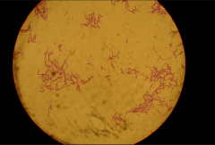 -Rod-shaped, cylindrical cells 


Monobacillus
-Singly
Diplobacillus
-Pairs
Streptobacillus
-Chains