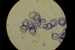 -A filamentous aquatic species 

 -Strands of individual vegetative cells are housed in a gelatinous sheath 


 -Heterocysts produce enzymes which are capable of fixing atmospheric nitrogen, and serve an important role in retailing nitrogen to aqu...