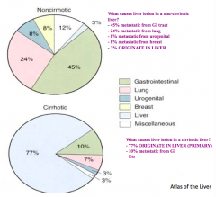 - Non-cirrhotic: most likely to be a metastases from elsewhere (only 3% originate in liver)

- Cirrhotic: most likely to be a primary lesion (77% originate in liver)