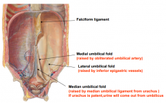 lateral umbilical fold 