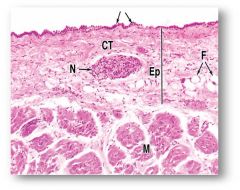What are the layers of the epicardium? Describe these layers and its histology.