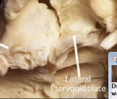 PTERYGOID PLATES