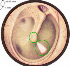 1. What are the two circled structures?2. What innervates this membrane?