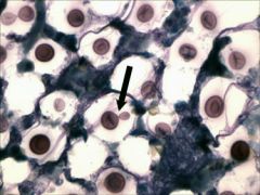Cryptococcus neoformans. (most common fungal dz in cats)
