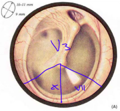 1. Umbo (tip of the malleus) and cone of light of the tympanic membrane

2. external surface = V3, VII, X
internal surface = IX