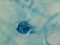 Identify the Genera and which type of reproduction , Major Clade, Supergroup, and Domain


heterotroph or autotroph