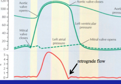 When does ascending aortic blood flow peak?
Is there any retrograde flow? Why?