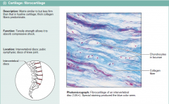 Fibrocartilage Cartilage