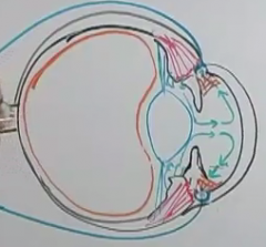because the pupillary dilator muscle are contraction and taking up space at the angle