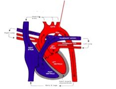 the shunt normal in fetal circulation, should could upon birth. failed closure results in blood flowing back into the R side of the heart.