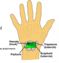 flexor retinaculcum (band retainer) 
- OR transverse carpal ligament

holds tendons in place
forms roof of carpal tunnel 