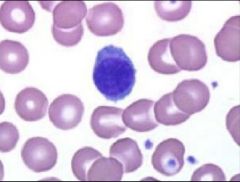 Smallest WBC, Nucleus is stained dark blue/purple and spherical; accounts for most of the cell mass