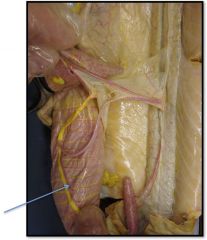 dogfish artery