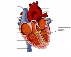 The interventricular septum separates the ventricles.