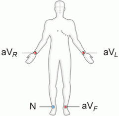 An ECG that uses 4 leads attached to the patient's skin; these include the limb leads.