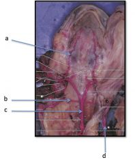 a) Carotid Artery
b) Subclavian Artery
c) Dorsal Aorta
d) Pulmonary Artery