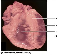 a) fat in interventricular
sulcus
b) left ventricle
c) right ventricle
d) anterior interventricular
artery
