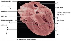 Mammalian Heart
a) interatrial septum
b) tendinous cords
c) endocardium
d) myocardium
e) epicardium
f) base of heart
g) trabeculaeg carneae
h) papillary muscles
i) epicardial fat
j) interventricular septum
k) apex of heart